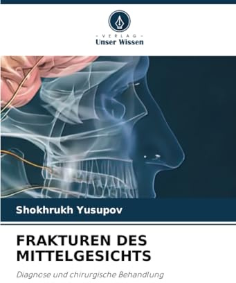 FRAKTUREN DES MITTELGESICHTS: Diagnose und chirurgische Behandlung