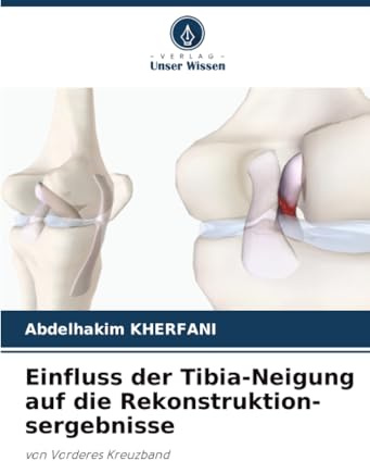 Einfluss der Tibia-Neigung auf die Rekonstruktion-sergebnisse: von Vorderes Kreuzband