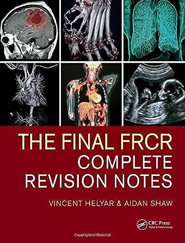 The Final FRCR: Complete Revision Notes