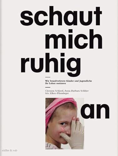 Schaut mich ruhig an: Wie brandverletzte Kinder und Jugendliche ihr Leben meistern
