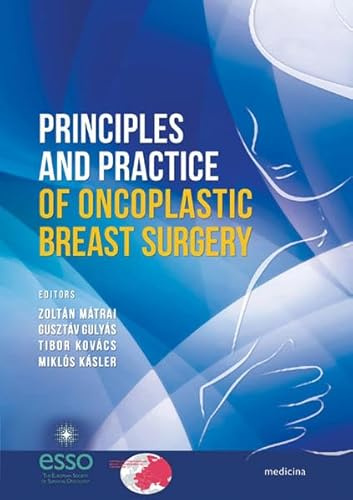 Principles and Practice of Oncoplastic Breast Surgery