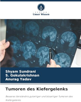 Tumoren des Kiefergelenks: Besseres Verständnis gutartiger und bösartiger Tumoren des Kiefergelenks