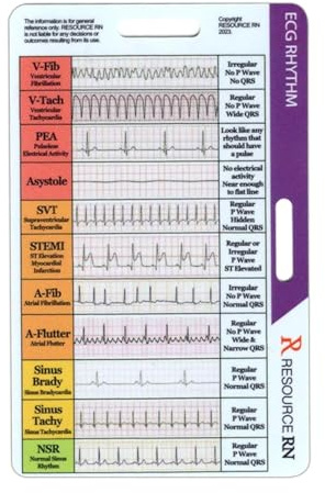 EKG-Taschenkarte – EKG-Lineal, EKG-Karte, EKG-Rhythmus-Taschen-Karten, EKG-Rhythmus-Interpretations-Abzeichen-Karte, EKG/EKG-Rhythmusführung, Taschenkarte, EKG-Abzeichenkarte, doppelseitiges