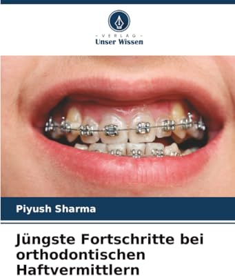 Jüngste Fortschritte bei orthodontischen Haftvermittlern: DE
