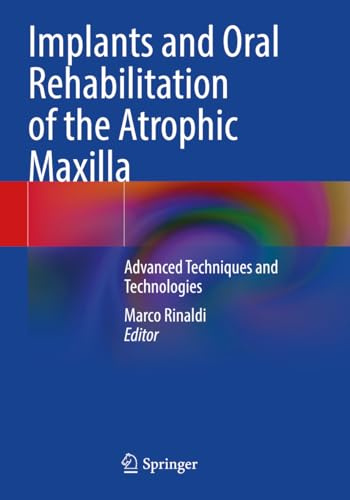 Implants and Oral Rehabilitation of the Atrophic Maxilla: Advanced Techniques and Technologies
