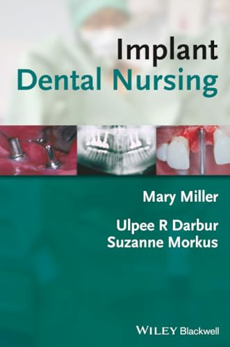 Implant Dental Nursing