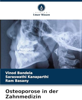 Osteoporose in der Zahnmedizin