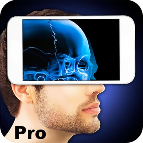 Xray Scanner Head No Ads