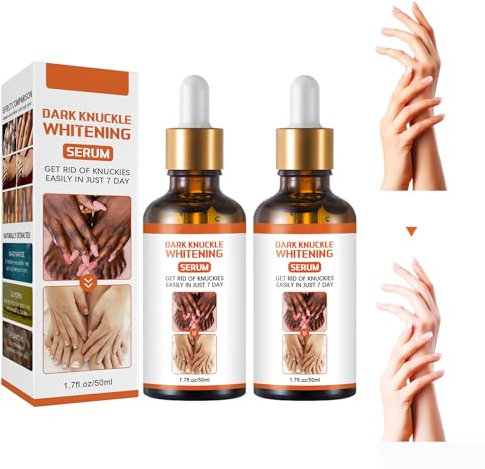 Snow Bleach 2Pcs Dunkle Knuckle Whitening Cream,Hautaufhellendes, Acanthosis Nigricans Therapy Oil,Dark Knuckle Whitening Serum,Joint Darkening Serum,Für Achselhöhlen,Ellbogen,Brust,Knie