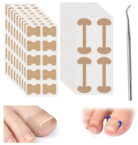 Ingrown Toenail, 129Pcs Ingrown Toenail Treatment Ingrown Toenail Kit for Nails Health, Includes 80 Pcs Ingrowing Toenail Treatment Patch, 48 Pcs C Shape Filling Pad, and 1 Styles Ingrown Toenail Tool