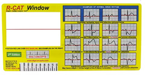Fenêtre R-CAT EKG 2e édition