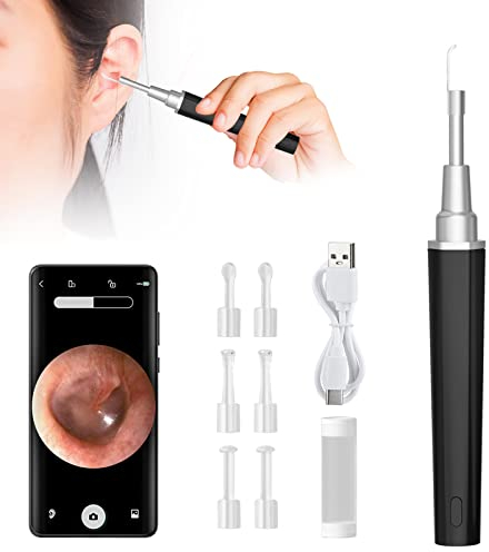 Ohrenschmalz-Entferner Otoskop,Intelligenter Thermostat WiFi Otoskop Ohrreiniger mit LED,5 Millionen Pixel HD WIFI Ohren Reinigung Ohrenschmalz,für Kinder Erwachsene und Älteste (Schwarz)