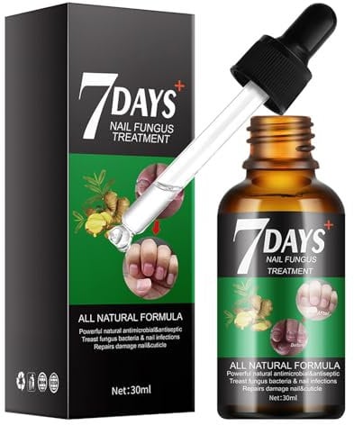 Nail Fungas Treatmant for Toenail - Toe Nail Fungas Treatmet - Toenail Fungul Treatmant Extra Strong - Anti Fungas Nail Repeir and Strengthen, Fix & Renew Damaged, Broken Nails