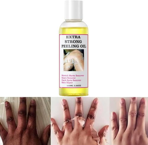 Körperpeeling Peeling-Öl für dunkle Haut, Chemisches Peeling für Gesicht und Körper, Exfoliating Gel für alle Hauttypen, 110 ml (1 PCS)