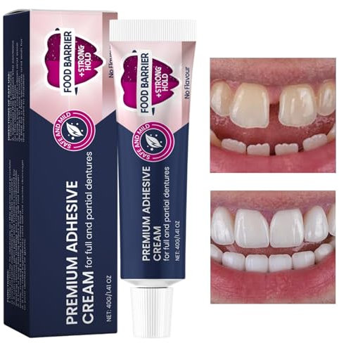 Secure Prothesenkleber, Secure Prothesencreme - 40g Prothesenpflegekleber,Erneuert und festigt lose Zahnprothesen, Haftcreme für Ober-, Unter- oder Teilprothesen