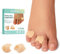 Welnove Séparateurs d'orteils en gel, petits coussins d'orteils, petits embouts d'orteils pour prévenir les frottements et soulager la pression (lot de 8, beige)