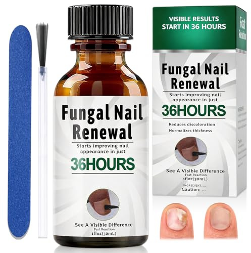 30ml Gotas Para Cuidado De Uñas De los Pies, Cuidado Uñass Dañadas, Calmar y Nutrir Las Uñas,Cuidados Diaria y Mejora Aspecto Pie, Fortalece la Estructura de la Uña