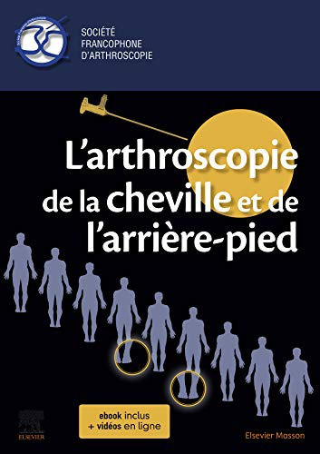L'arthroscopie de la cheville et de l'arrière-pied (Hors collection) (English Edition)