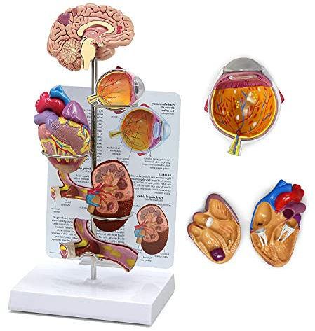 UIGJIOG Bluthochdruck-Modell Miniatur-Gehirn-, Augen-, Herz-, Nieren- und Arterienmodelle Set Menschliche Körperanatomie-Nachbildung Bluthochdruck-Modell für Lehrmittel