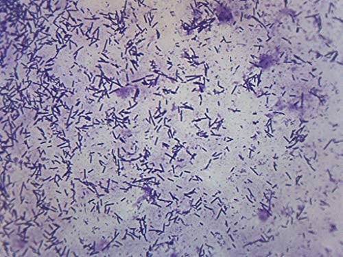 EISCO Escherichia Coli Smear, Gram Stain - Prepared Microscope Slide - 75 x 25mm - Biology & Microscopy