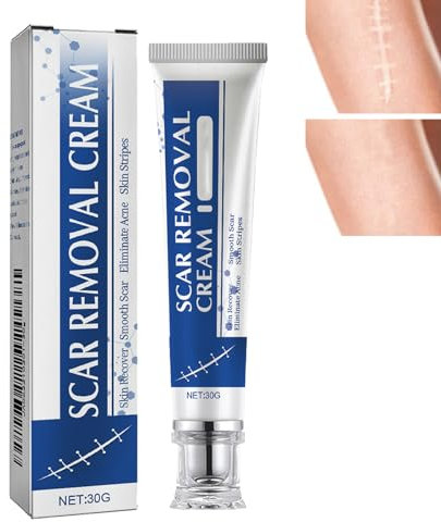 KOAHDE Gel de Cicatrice en Silicone,Gel Réparateur de Cicatrices,Élimination Des Cicatrices,Crème Eliminatrice De Cicatrices,Creme Anti Vergeture,Crème pour Eliminer les Cicatrices,30G