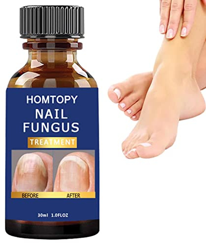 uñas,Solución Hongos Extra Fuerte para Uñas - Funguses Proof Na Renewal Parches para uñas Fórmula Fuerza máxima para uñas dañadas y descoloridas