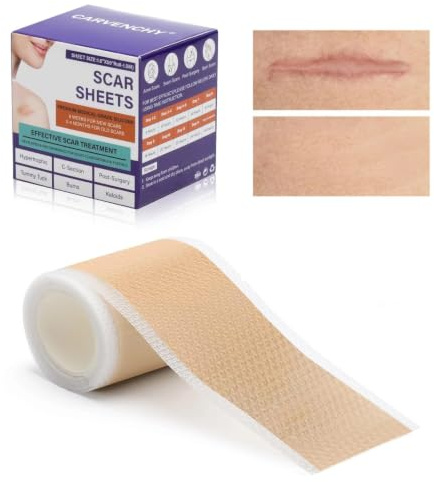 Silikonpflaster für Narben 1.6x59-1.5M Silikon Narbenpflaster, Silikon-Narbenblätter Silicone Scar Tape Wiederverwendbares Narbenband für Kaiserschnitt, Akne, Chirurgische Narben, Keloid