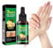 Ginger Nail Growth Serum, 7 days Nail Treatment,Ginger Nail Growth Serum,Nail Strengthener For Damaged Nails,Ginger Nail Serum,Ginger Nail, Nail Nail Care