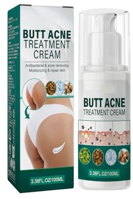 Creme zur Behandlung von Gluteekorn,Akne-Entferner im Gesäß,Milde Zutat,Porentiefe Reinigung, Gleicht Hautfeuchtigkeit und Öl aus, Einfach zu Verwenden