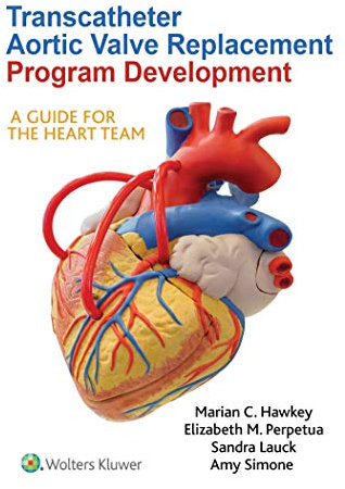 Transcatheter Aortic Valve Replacement Program Development: A Guide for the Heart Team (English Edition)