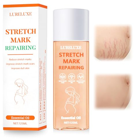 125ml Mama Schwangerschaftsöl, Während und nach der Schwangerschaft Körperöl, Körperöl für Dehnungsstreifen, Hautpflege Schwangerschaft MassageÖl, Dehnungsstreifen Vorbeugung