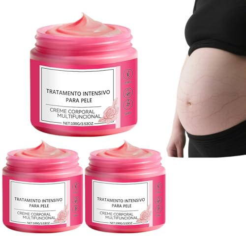 Crema per smagliature con acqua di rose e glicerina, crema corpo idratante da 100 ml per una migliore elasticità e idratazione della pelle, 3 pezzi