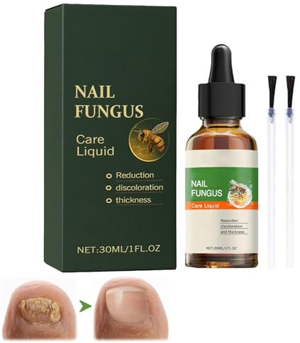 Nagelpflege Behandlung,Nagelpilz Behandlung Schnell Intensiv,Repariert Beschädigte/Verfärbte Nägel,Nagelhärter,Verfärbte Finger-Näge, repariert brüchige