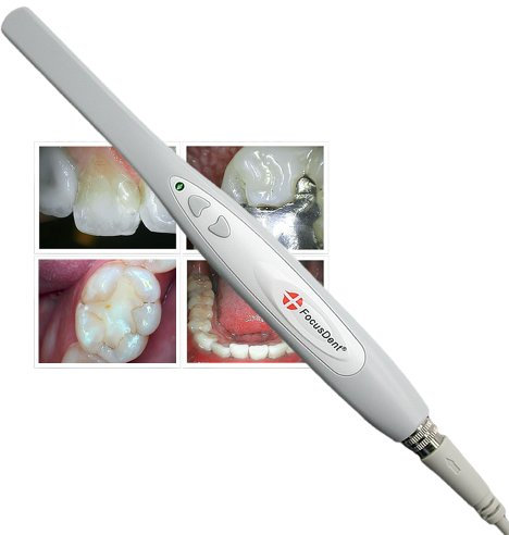 FocusDent MD740 USB Intraorale Kamera - Intraoralkamera - Zahnarztkamera - USB Plug & Play, 6 LED, 1.3 Mega Pixels - Bildbearbeitungssoftware enthalten