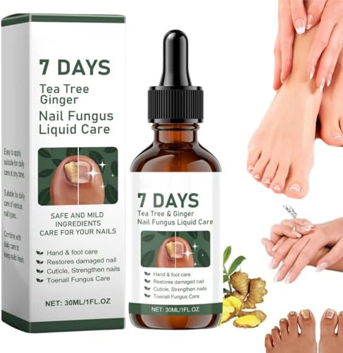 7 Days Nail Fungus Treatment, Nail Fungus Treatment For Toenail, Tea Tree Ginger Nail Fungus Treatment, Fungal Nail Treatment, Toenail Fungus Treatment, 30ml (1pc/30ml)