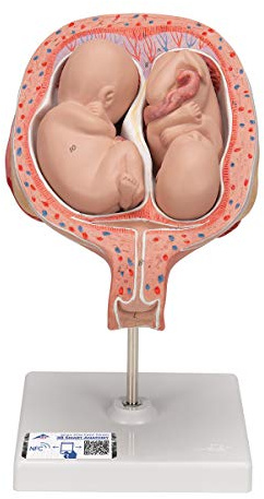 3B Scientific Menschliche Anatomie - Zwillingsfeten, 5. Monat, normale Position + kostenlose Anatomie App - 3B Smart Anatomy