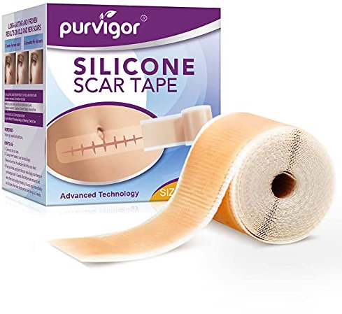 Pansement silicone cicatrice, feuille d'élimination des cicatrices, adoucissement et lissage des cicatrices chirurgicales, acné, brûlures (4cm X 1,5m)