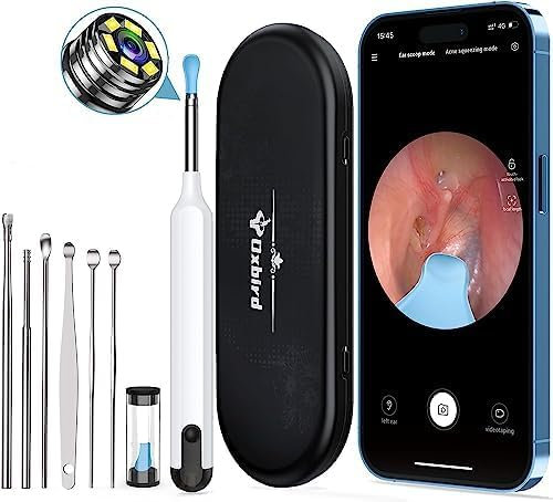 Oxbird Ear Wax Removal Kit Tool with Camera, 1080P Wireless Earwax Camera Ear Camera Otoscope Cleaner Smart Ear Cleaner with Camera and Light for iPhone, Ipad & Android Smart Phones (White)