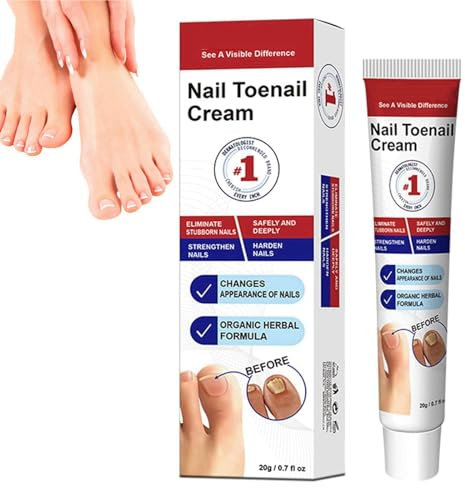 Fungal Nail Treatment Cream,Anti Fungus Nail Cream,Nail Fungus Treatment for Toenail,Strong Anti-Fungal Toenail Cream,Toenail Fungus Treatment,Nail Repair Cream for Thick Cracked Discolored Nails
