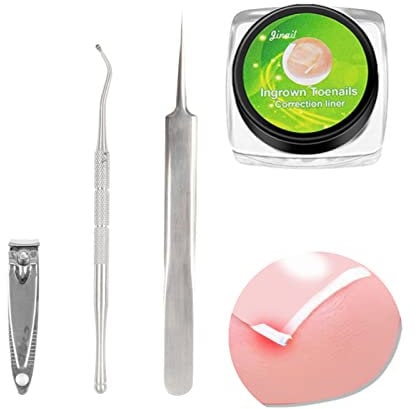 12Pcs Ingrown Toenail Straightener Strips Toenail Correction Kit Toenail Corrector Straighte with 3Pcs Ingrown Toenail File And Lifter Clamp for Women Men Nail Treatment Pedicure Tool