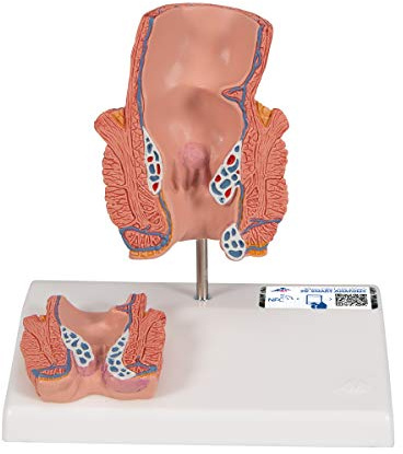 3B Scientific Menschliche Anatomie - Hämorrhoidenmodell + kostenlose Anatomie App - 3B Smart Anatomy