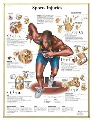 XLJP 1PC Muskel System Anatomisches Poster Muskel Anatomie Diagramm Anatomisches Diagramm Menschlichen Körper Lehrmittel for Menschliche Anatomie Poster ( Color : Q1312 , Size : 30x45cm no frame )