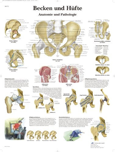 3B Scientific Lehrtafel - Becken und Hüfte - Anatomie und Pathologie, VR0172UU