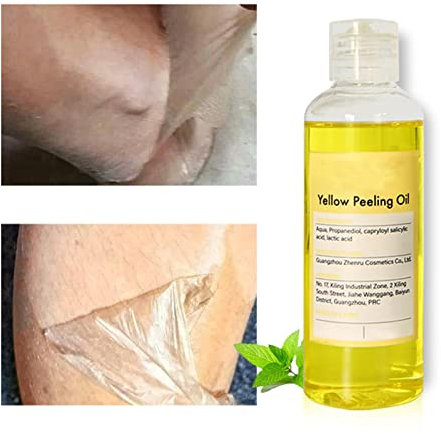Peeling-Gel Extra Stark - Aufhellendes Gesichts- Und Körperpeeling Für Dunkle Haut Und Flecken, Peeling-Öl (100 ML / 3.5 OZ)