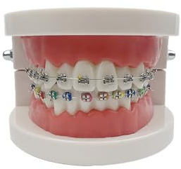 Dental Orthodontic Model, YOUYA DENTAL Demonstration Orthodontic Model Teeth Teach Study Tools with 1/2Metal and 1/2Metal self-Locking Bracket(Red)
