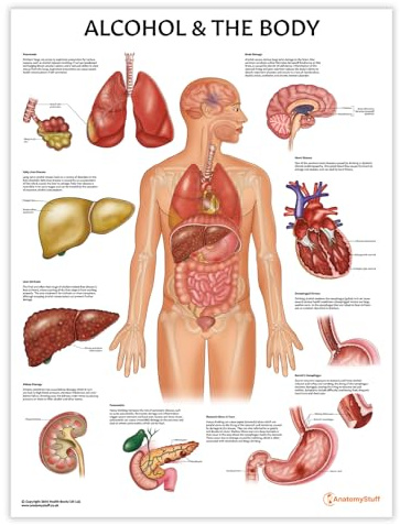 Poster Alcohol and The Body, 45 x 60 cm, menschliche Anatomie, anatomisches Poster für Bildung, Lernen und Studenten, Alkoholeffekte auf den menschlichen Körper, Pathologie-Poster
