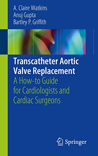 Transcatheter Aortic Valve Replacement: A How-to Guide for Cardiologists and Cardiac Surgeons (English Edition)
