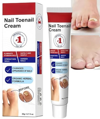 Fungal Nail Treatment Cream,Strong Anti-Fungal Toenail Cream,Fungal Nail Treatment for Toenail Fungus,Repair Cr/eam for Cracked Discolored Nail,Nail Growth Na/il Repair,Ingrown Toen/ail Treatment