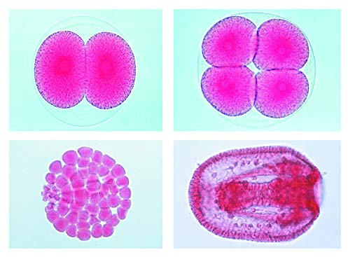 LIEDER Biologie Mikroskopie Mikropräparate Serien: Entwicklung des Seeigels (Psammechinus miliaris), 12 Präparate