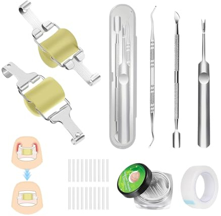26 Stücke Zehennagel Korrektur Nagelspange Fußnägel Ingrown Toenail Eingewachsene Zehennägel Set Gilt Für Deformierte Nägel Mit 2 Nagelkorrekturspange 20 Nagelpads 3 Nagelknipser 1 Klebeband